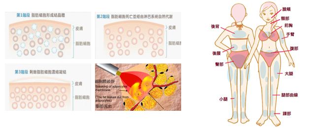 上海皮秒激光祛斑间隔多久做一次?多久做一次比较好?