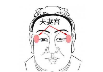 上海内切眼袋术后护理怎么做?