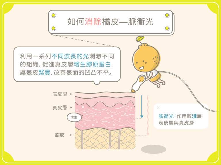 美莱做一个双眼皮埋线能坚持多久