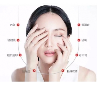 美莱医生教你:鼻头缩小怎么预防增生?