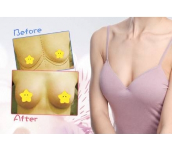 上海做自体脂肪隆鼻的效果如何