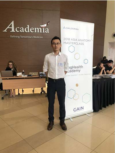 上海割双眼皮效果好不好