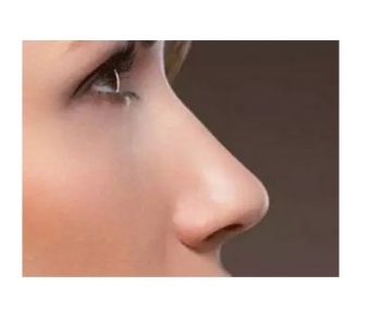 祛眼袋手术失败怎么修复