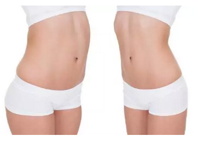 祛眼袋手术失败怎么修复