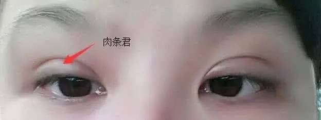 <a href='/' target='_blank'><u>上海美莱</u></a>做激光祛痘坑的术前术后注意事项都有哪些