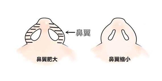 上海隆胸的危害有哪些?