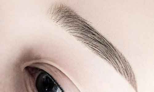 美莱割双眼皮后几天消肿?