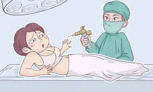 上海去眼袋效果可维持几年时间?