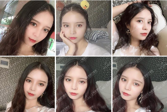 上海激光祛斑后不能吃什么食物?