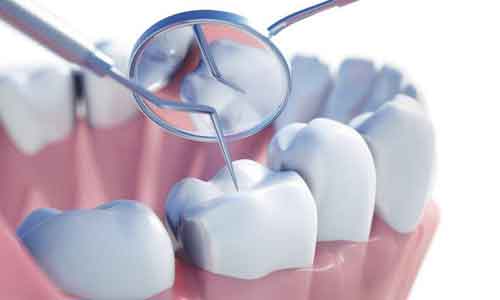 做过激光祛斑后不能吃什么