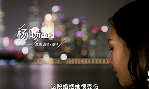 上海做完大腿抽脂几天拆线