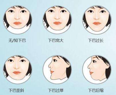 上海一年要做几次无针水光比较合适