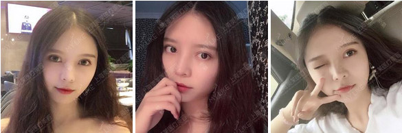 美莱医生代表受邀参加2019鼻修复大会?