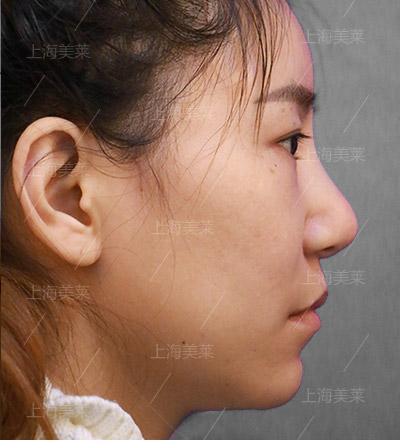 美莱受邀出席瑞典第十五届医疗整形学术大会