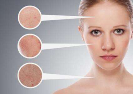 全切双眼皮术前要注意些什么