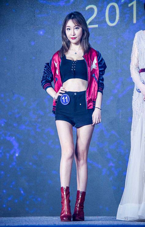 上海割双眼皮多久能恢复好