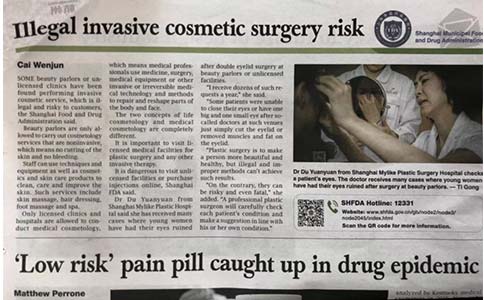 上海埋线双眼皮多久可以洗脸呢