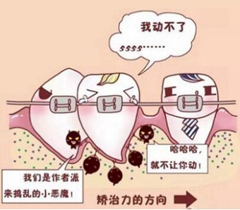 上海埋线双眼皮多久可以洗脸呢