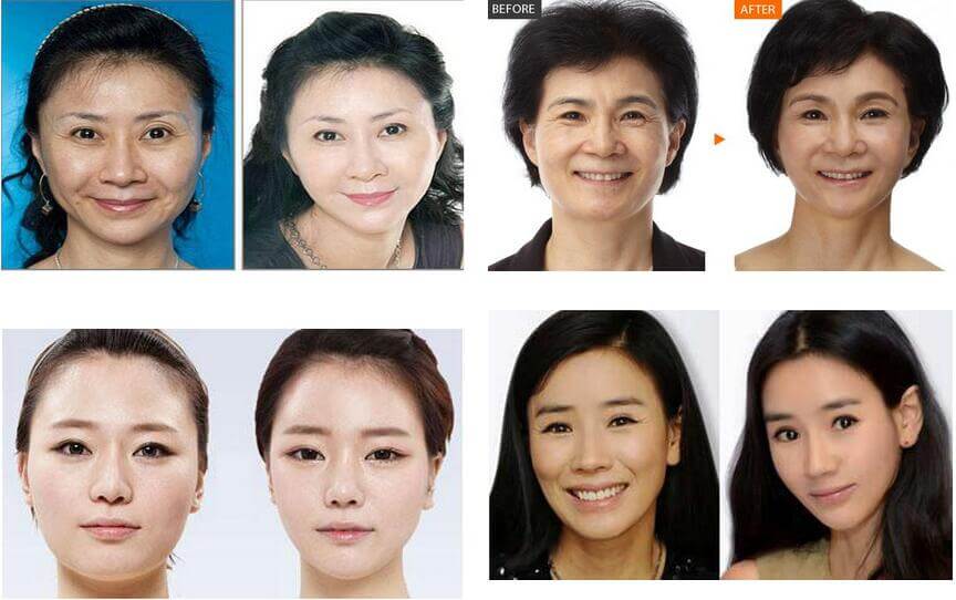 上海戴牙套影响怀孕吗