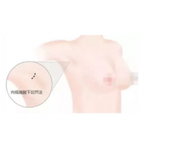 上海戴牙套影响怀孕吗