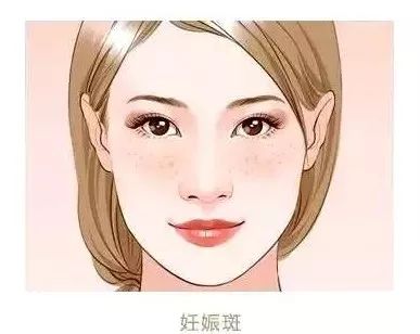 上海做个激光祛眼袋多少钱