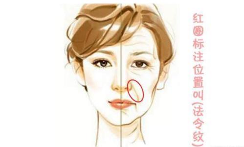 上海激光去眼袋效果好不好