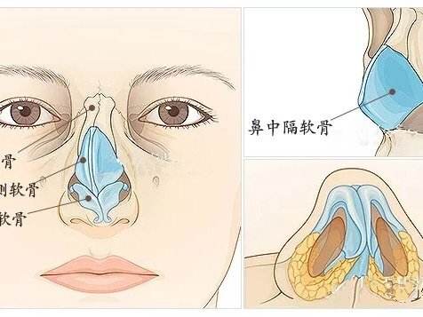 上海割双眼皮几天可以拆线