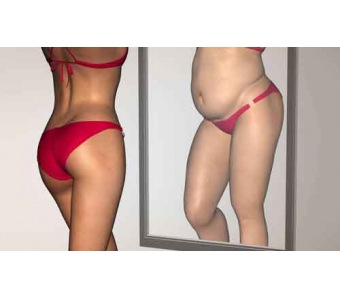 上海美莱·Dallas STAR 全肋技术升级,新品发布会圆满结束