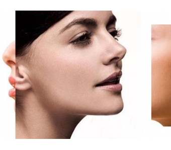 上海美莱·Dallas STAR 全肋技术升级,新品发布会圆满结束