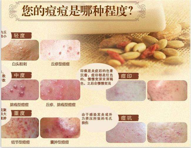 上海抽脂减肥要住院吗