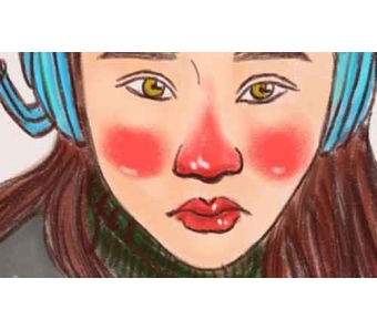 上海激光去黑眼圈效果好吗