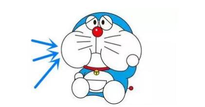 上海隆鼻假体取出要多少钱