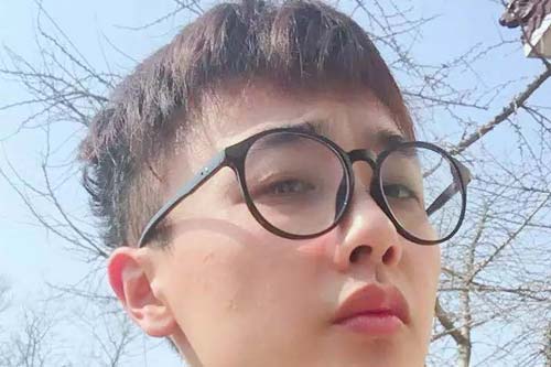 上海隆鼻假体取出要多少钱