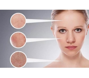 上海开眼角多久能恢复自然