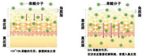 上海吸脂减肥会不会反弹