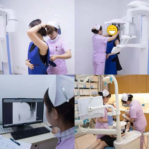 上海开眼角什么时候恢复自然