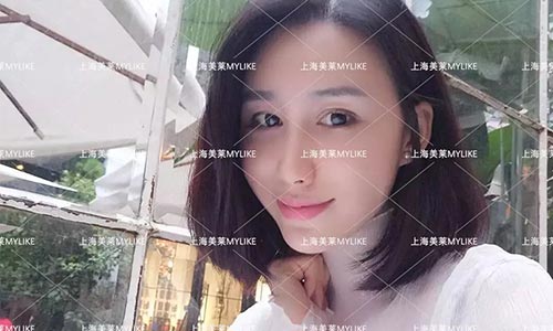 上海激光祛斑会损伤好的皮肤吗