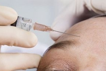 上海全切双眼皮的恢复期是多久