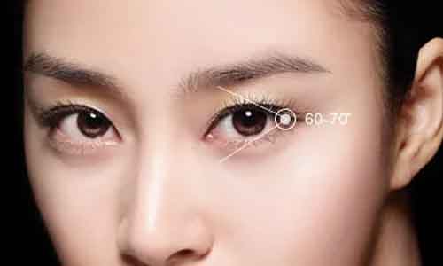 上海割双眼皮几天可以拆线呢