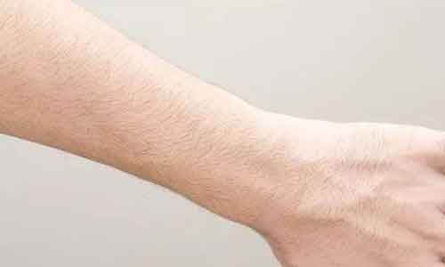 上海割双眼皮几天可以拆线呢