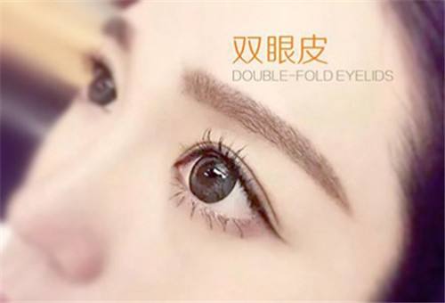 上海开眼角后几天可以拆线