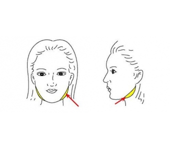 上海全切双眼皮多久恢复
