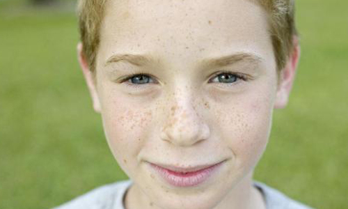 上海切开双眼皮多久恢复自然