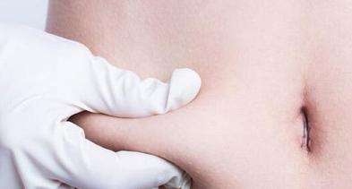 上海埋线双眼皮多久可以化妆