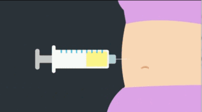 上海激光脱毛的过程是什么样子的