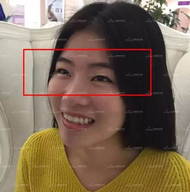 上海激光美白的价格是多少钱