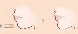 <a href='/' target='_blank'><u>上海美莱</u></a>酷塑形体案例招募中...