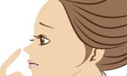 上海美莱酷塑形体案例招募中...