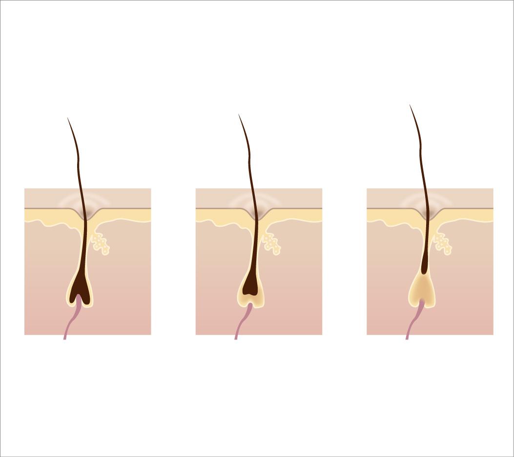 上海割双眼皮的恢复是多久,期间要注意什么
