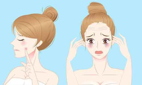 上海割双眼皮的恢复是多久,期间要注意什么